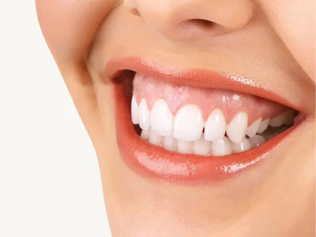 لبخند لثه ای (گامی اسمایل)