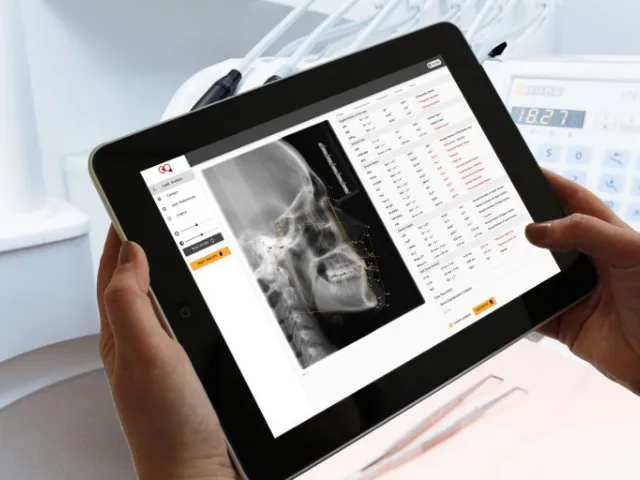 تریس لترال سفالومتری