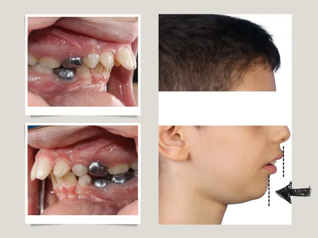 درمان فانکشنال