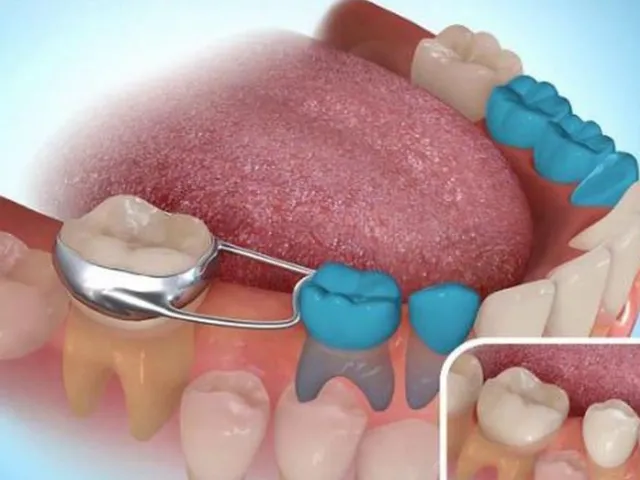 کاربرد  و اهمیت فضا نگهدار