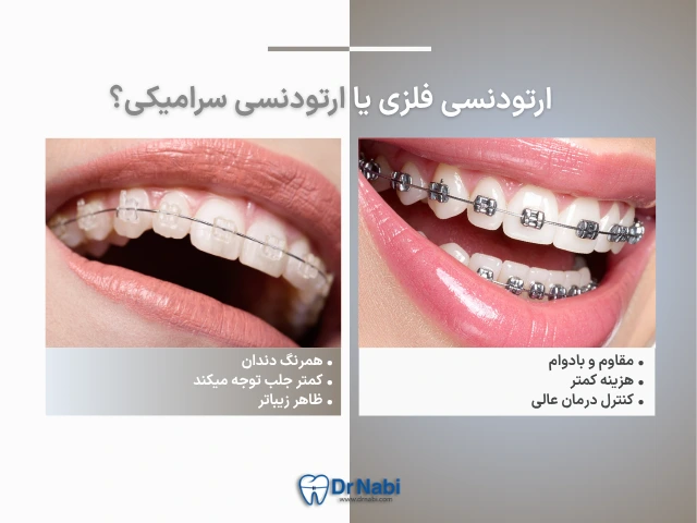 ارتودنسی سرامیکی بهتر است یا فلزی؟ راهنمای انتخاب بر اساس شرایط شما