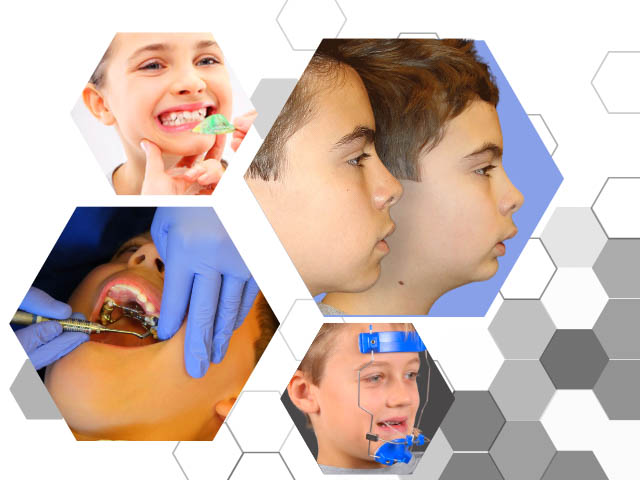 دوره پیشگیری ارتودنسی با مجوز وزارت بهداشت