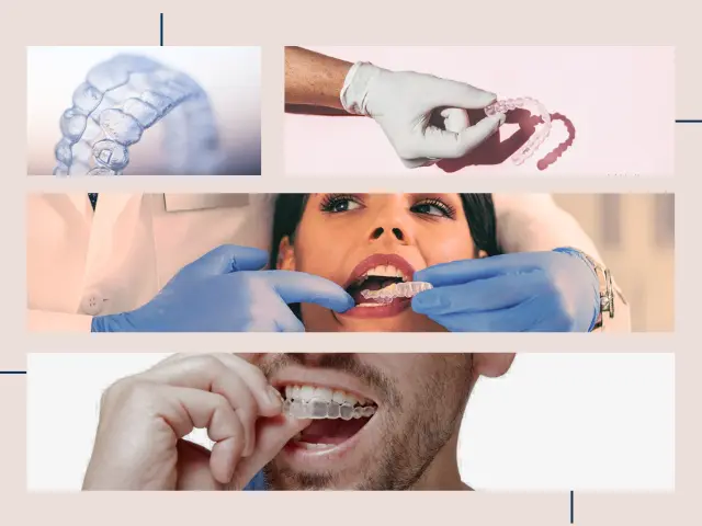 ارتودنسی نامرئی، مزایا، هزینه و الاینر شفاف با دکتر نبی