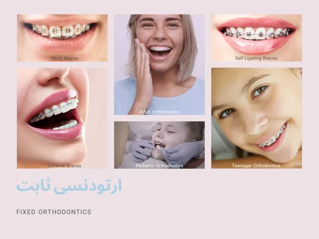 راهنمای کامل ارتودنسی ثابت