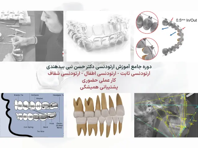دوره جامع آموزش ارتودنسی دکتر نبی بیدهندی  ویژه دندانپزشکان