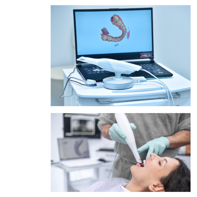 اسکن داخل دهان Intraoral Scan اسکن دیجیتال داخل دهان بیمار (Intraoral Scan) قبل از شروع درمان ارتودنسی
