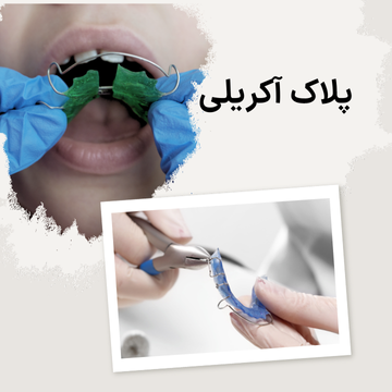 نما پلاک آکریلی ارتودنسی اطفال داخل دهان ونما کلوزآپ پلاک آکریلی دردست دندانپزشک در یک تصویر