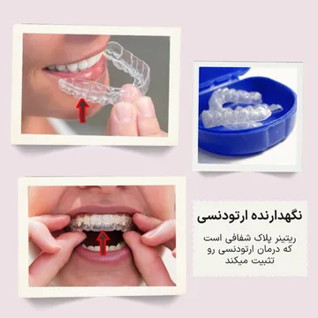 سه تصویر از ریتینر ارتودنسی پس از پایان درمان شامل دو تصویر ریتینر روی دندان‌ها و یک تصویر از ریتینر داخل جاپلاکی