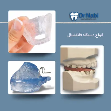 انواع دستگاه های فانکشنال شامل مونو بلاک، مونو بلاک با آرک جلو و تویین بلاک در ارتودنسی اطفال