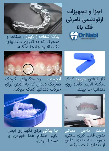 الاینر فک بالا، اتچمنت، چوییز، اسکنر داخل دهانی و جا پلاکی در ارتودنسی نامرئی.