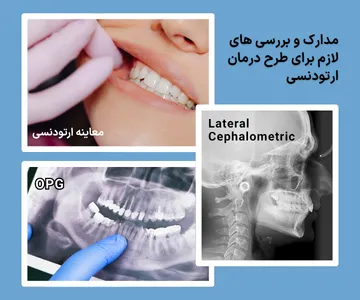 مدارک تشخیصی ارتودنسی شامل فتوگرافی، OPG و سفالومتری مدارک تشخیصی ارتودنسی شامل عکس فتوگرافی داخل دهان، رادیوگرافی OPG و سفالومتری برای برنامهریزی طرح درمان