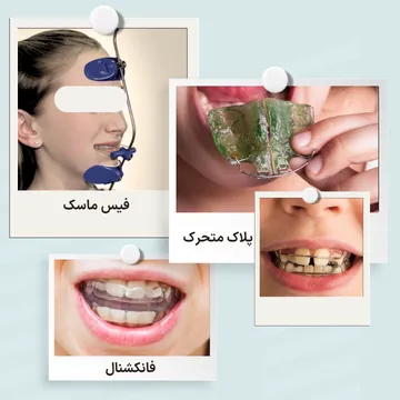 انواع ارتودنسی متحرک شامل پلاک متحرک، فیس ماسک و دستگاه فانکشنال انواع دستگاه های ارتودنسی متحرک شامل پلاک متحرک، فیس ماسک و دستگاه فانکشنال برای اصلاح مشکلات دندانی و فکی کودکان