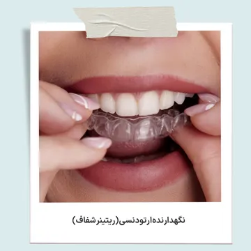 ریتینر شفاف برای حفظ نتایج ارتودنسی نگهدارنده شفاف ارتودنسی یا ریتینر شفاف برای جلوگیری از بازگشت دندان ها پس از پایان درمان
