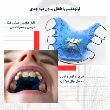 درد ارتودنسی کودکان با پلاک متحرک چقدر است؟ تصویر پلاک متحرک ارتودنسی کودکان برای اصلاح رشد فک و دندان ها که میزان درد آن معمولاً خفیف بوده و کودک پس از چند روز به دستگاه عادت میکند.