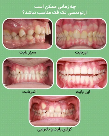 ناهنجاری هایی که ممکن است ارتودنسی تک فک را محدود کنند نمونه هایی از ناهنجاری های بایت و رابطه فکی شامل اپن بایت، اوربایت، آندربایت، کراس بایت و جلو بودن فک بالا که ممکن است نیاز به درمان هر دو فک داشته باشند