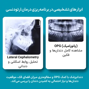 بررسی نیاز به کشیدن دندان با عکس OPG و سفالومتری نمونه عکس OPG و لترال سفالومتری برای تشخیص کمبود فضا و بررسی نیاز به کشیدن دندان قبل از ارتودنسی