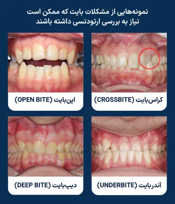 انواع بایت نامناسب؛ کراسبایت، اپنبایت، آندربایت و دیپبایت کلاژ تصاویر داخل دهانی بیماران با کراسبایت، اپنبایت، آندربایت و دیپبایت؛ نمونههایی از ناهنجاریهای بایت که در ارزیابی ارتودنسی بررسی میشوند.