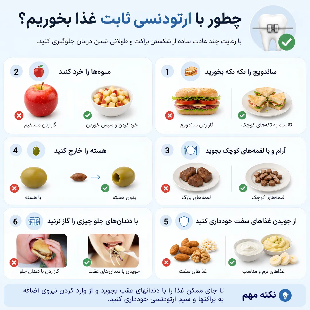 آموزش مرحله به مرحله نحوه غذا خوردن با ارتودنسی ثابت تصویر آموزشی مرحله به مرحله نحوه صحیح غذا خوردن با ارتودنسی ثابت شامل خرد کردن میوه، تقسیم ساندویچ به تکه های کوچک، خارج کردن هسته زیتون و خرما و برداشتن لقمه های کوچک.