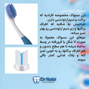 مسواک مخصوص ارتودنسی ثابت مسواک ارتودنسی ثابت با طراحی V شکل برای تمیز کردن اطراف براکت و سیم