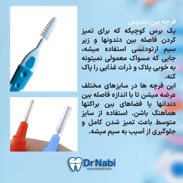 مسواک بین دندانی در ارتودنسی فرچه بین دندانی کوچک برای تمیز کردن اطراف براکت و زیر سیم
