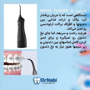 دستگاه واترجت برای شستشوی دندان در ارتودنسی واترجت دندانپزشکی برای تمیز کردن اطراف براکت و لثه با فشار آب